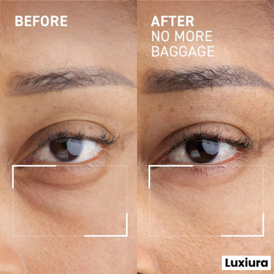 Luxiura™ Eye Cream (Massaging) - No More Puffy Eyes & Wrinkles