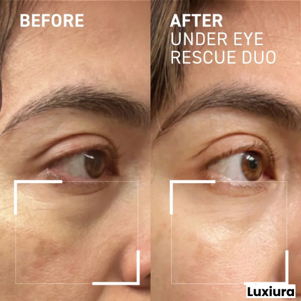 Luxiura™ Eye Cream (Massaging) - No More Puffy Eyes & Wrinkles