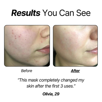 Bio-Collagen™ Real Deep Mask